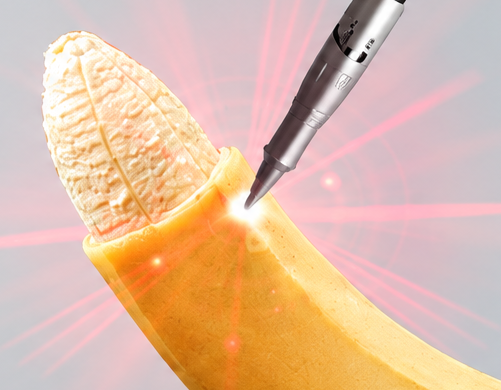 What is Laser Circumcision?
